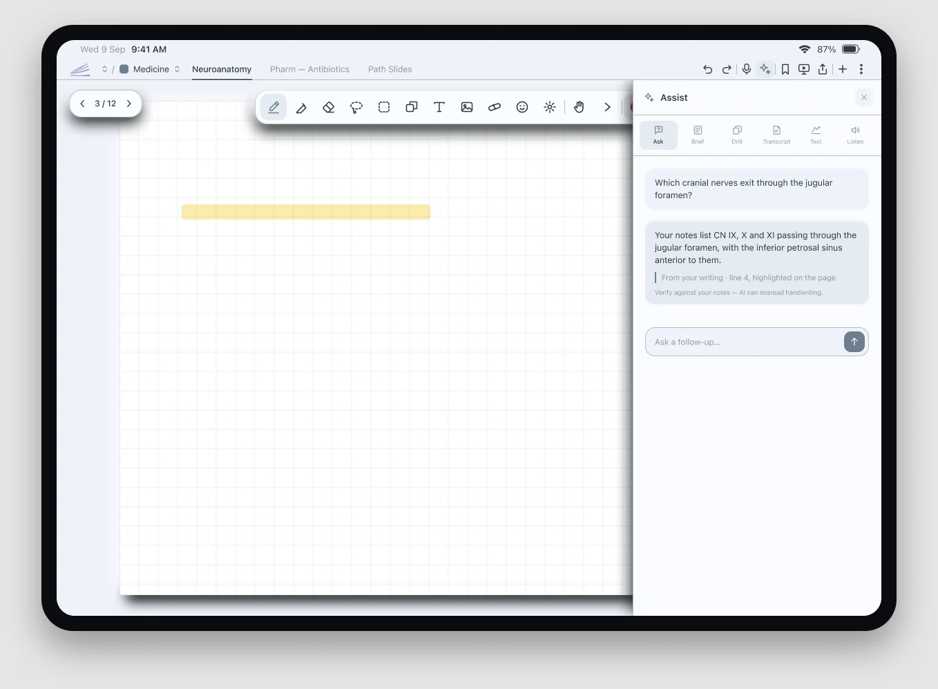 SpaceNotes Figma design showing the Ask about this page panel beside the notebook